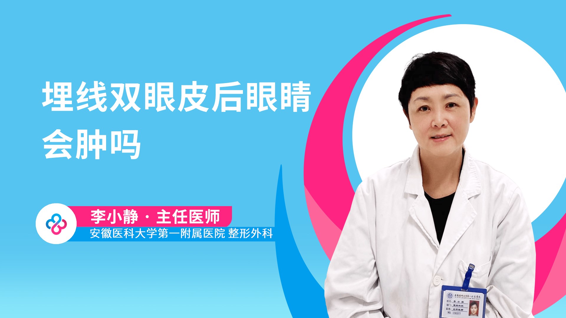 埋线双眼皮后眼睛会肿吗